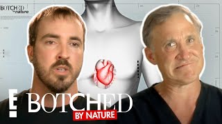 Brandons Chest Bubble Trouble FULL TRANSFORMATION  Botched By Nature  E [upl. by Hgielanna469]