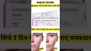 SkinLite Creame Review In Hindi  SkinLite Creame use kaise karen beautytips skinlite [upl. by Giffy]