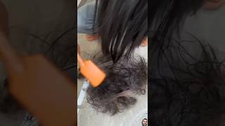 Stop Hair fall Home Remedies haircare hairtreatmentathome shorts [upl. by Bobina]