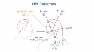 EBV and Mononucleosis  Pathogenesis and Clinical Presentation [upl. by Amoakuh]