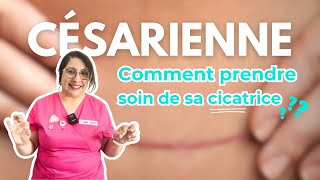 Comment masser sa cicatrice de césarienne [upl. by Nylesaj]