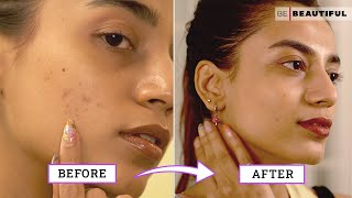 How To Improve Your Skin Texture  Skincare Tips For Bumpy Skin  Be Beautiful [upl. by Schapira]