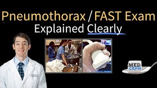 Pneumothorax on Ultrasound  FAST Exam Explained Clearly [upl. by Hale]