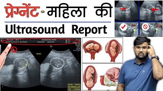 Pregnancy Ultrasound  Ultrasound Report  Medical  Doctor  MBBS  BHMS  BAMS  Nursing [upl. by Ynohtnaleahcim731]