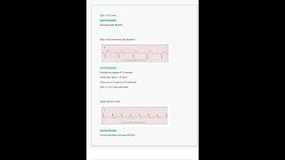 Relias Dysrhythmia Basic A Questions amp Answers All Correct amp Verified [upl. by Lirrehs]