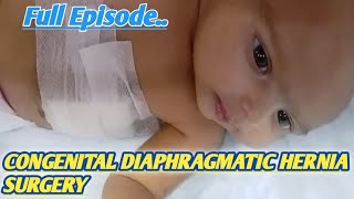 Newborn Vlog Congenital Diaphragmatic Hernia Surgerynewbornbabynewlyborn viralshortsviralvideo [upl. by Retsev]