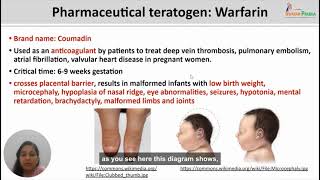 Teratogenesis part 2 [upl. by Kelly]