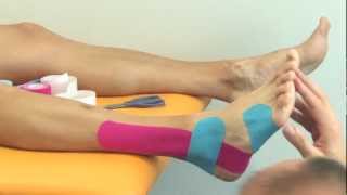 Kinesiology taping  Tejping kotníku oboustranně  varianta II [upl. by Gilbert]