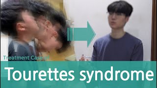 Tourettes Syndrome  Tic Disorder  voca tic  motor tic 틱 뚜렛 장애 치료사례 [upl. by Anesor]