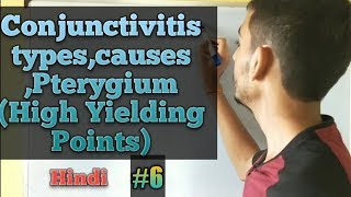 Conjunctiva anatomyConjunctivitishindi Pterygium vs Pinguecula Ophthalmology lectures in hindi [upl. by Enoid]