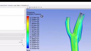 Numerical Results Velocity Profiles and Contours  Steady Flow in an Artery [upl. by Florinda421]