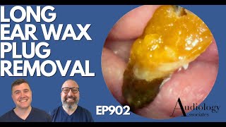 LONG EAR WAX PLUG REMOVAL  EP902 [upl. by Yruama]