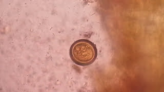 Egg of tapeworm or Taenia under the Microscope of saline preparation [upl. by Nibbor]