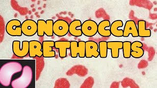 Gonococcal urethritis  Neisseria gonorrhoeae  clinical manifestations  Lab diagnosis [upl. by Ohcirej]