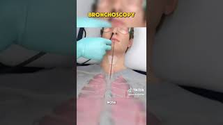 Bronchoscopy is a procedure that allows doctors to examine the lungs using a BRONCHOSCOPE🫁 [upl. by Oballa]