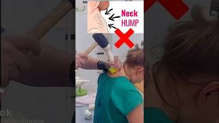 How To Gently Improve Your Posture￼ posture neckhump selfcare [upl. by Helfant]