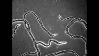 Myxobacteria  Moss Soil Isolate [upl. by Page]