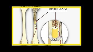 Knochenmarktransplantation Was es ist und mögliche Risiken und Komplikationen [upl. by Amoakuh]