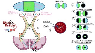 Visual Field Defects and Optic Nerve Pathway  Homonymous Hemianopia Bitemporal Hemianopia NEW 2020 [upl. by Warenne396]