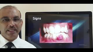 Pyogenic granuloma gums Patient teaching programme Malayalam [upl. by Goode]