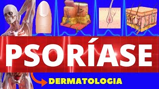 PSORÍASE  CAUSAS SINTOMAS E TRATAMENTO  CARACTERÍSTICAS DA PSORÍASE  DERMATOLOGIA [upl. by Inaffit]