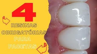 🛑4 RESINAS PARA FACETAS QUE NÃO PODEM FALTAR NO SEU KIT🤩🔥 [upl. by Otrebtuc601]