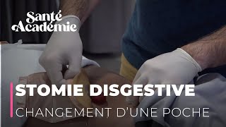 Stomie digestive  changer une poche en cas de fuite [upl. by Larimore]