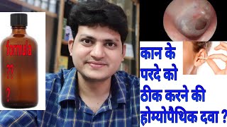 कान का पर्दा फटना । Homeopathic Medicine For Perforated Eardrum  explain  My formula [upl. by Aicnelev11]