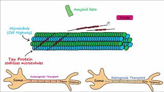 Alzheimers Disease  plaques tangles pathogenesis risk factors disease progression [upl. by Aleras942]