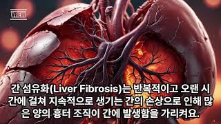 되돌릴 수 있었는데 간섬유화Liver Fibrosis [upl. by Sldney]