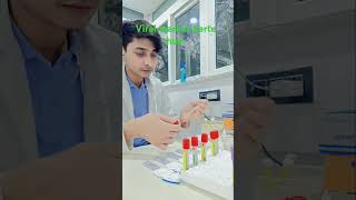 Viral marker test HCV HIV HBsAG VDRL bloodtestkaisehotahai bloodtest [upl. by Saber]