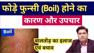 How to Treat Boil At Home  What causes Boil and Preventions Methods [upl. by Ginni766]