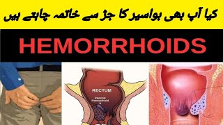 How To Get Rid Hemorrhoid [upl. by Ettezoj474]