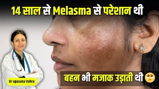 How to Treat PIGMENTATION  Dr Upasana Vohra  Melasma Treatment Patient Review [upl. by Eirojram]