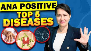 Top 5 Diseases with A Positive ANA Antinuclear Antibodies Test [upl. by Ahsinek]