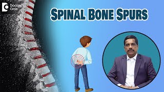 Spinal Bone Spurs  Symptoms amp Treatment Osteophytes  Dr Kodlady Surendra Shetty Doctors Circle [upl. by Jeconiah815]