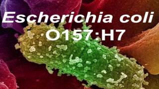 Escherichia coli Infecciones digestivas y Sindrome Uremico Hemolitico [upl. by Andromede172]