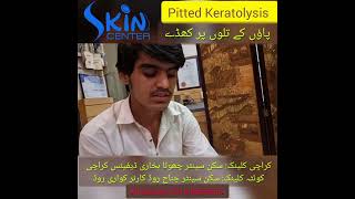 Pitted Keratolysis  Dermatologist  Dr Syed Bilal Shams skincenterpakistan [upl. by Salome]