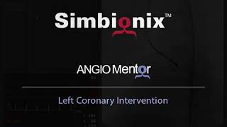 Coronary Angioplasty and Stenting Procedure on Simbionix ANGIO Mentor [upl. by Talbot]