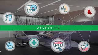 Alvéolite dentaire  étiologie  symptômes et traitement dentist [upl. by Notgnilra]