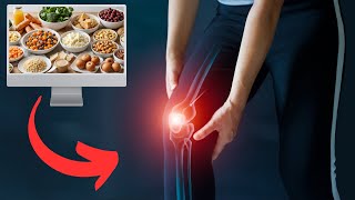 Best And Worst Foods For Arthritis Pain  What To Eat [upl. by Glennis]