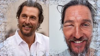 Mathew McConaughey shares scary swollen eye photo [upl. by Peterus996]