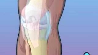 PreOp® Anterior Cruciate Ligament Patient Education [upl. by Gussman]