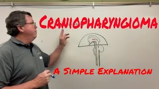 Craniopharyngioma A Simple Explanation [upl. by Cornelle756]