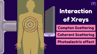 Scattering of Xrays  Compton  Coherent  Photoelectric effect  Oral radiology  Animated [upl. by Llehcnom]