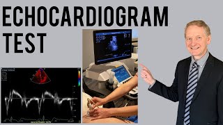 Echocardiogram Procedure  Heart Ultrasound  Everything you need to know [upl. by Cirnek]