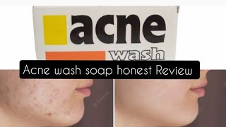 Best acne solutionAcne wash soap honest ReviewBest Soap for acneOrganic beauty and health [upl. by Enaled]