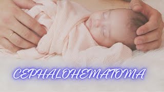 WHAT IS THE CEPHALOHEMATOMA [upl. by Millie344]