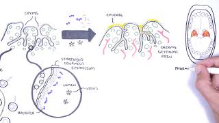 Tonsils  Clinical Anatomy Palatine lingual tubal adenoids [upl. by Annahvas]