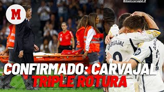 Carvajal confirma que tiene una lesión en el ligamento cruzado I MARCA [upl. by Coughlin]